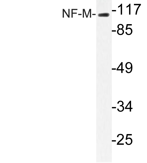 Anti-NF-M Antibody