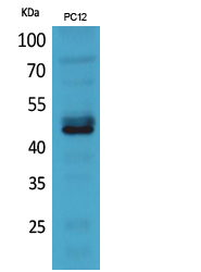 Anti-NCR2 Antibody