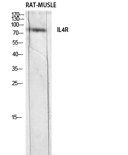 Anti-IL4R Antibody Anti-IL4R Antibody