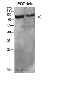 Anti-IL4R Antibody Anti-IL4R Antibody
