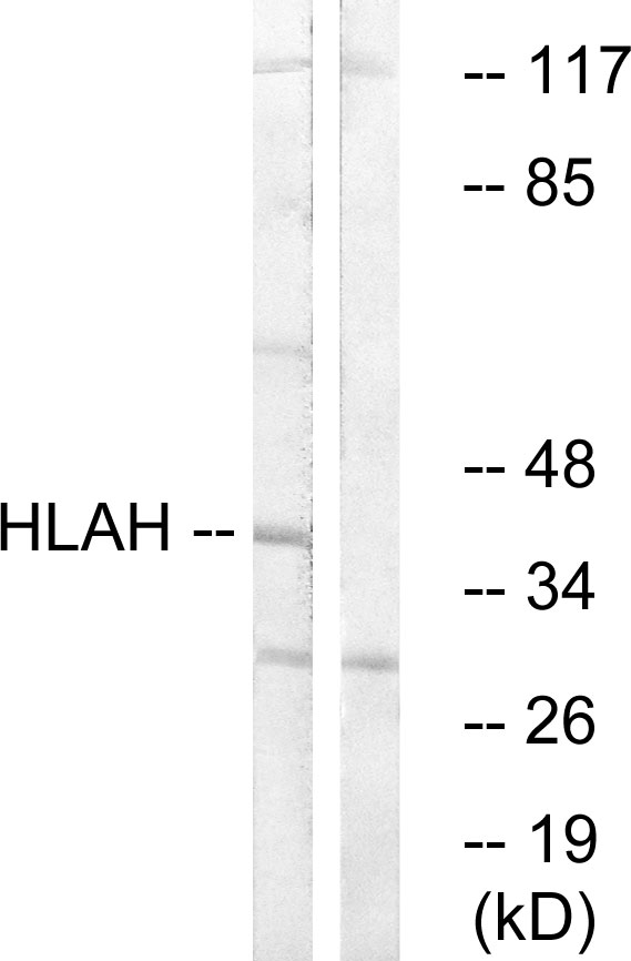 Anti-HLAH Antibody