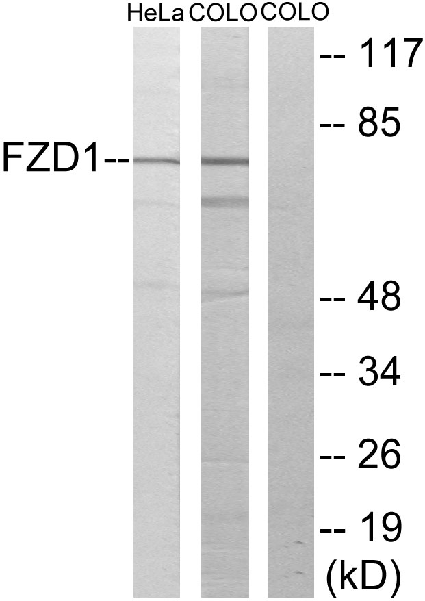 Anti-FZD1 Antibody