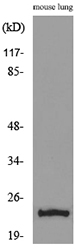 Anti-EDN1 Antibody