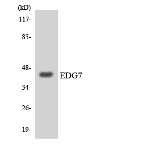 Anti-EDG7 Antibody