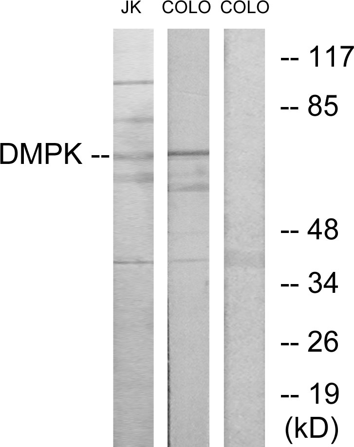 Anti-DMPK Antibody