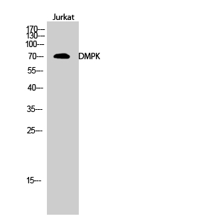 Anti-DMPK Antibody Anti-DMPK Antibody