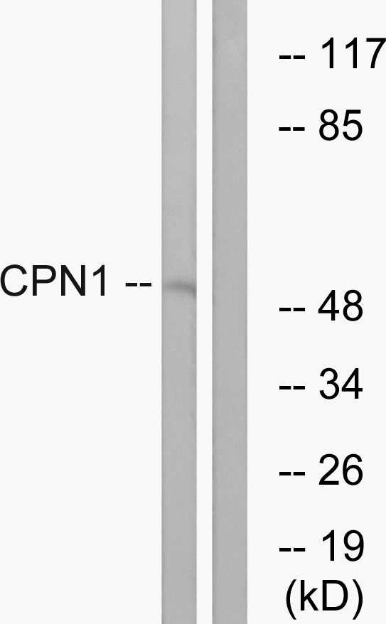 Anti-CPN1 Antibody