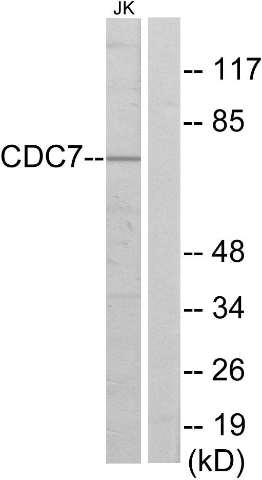 Anti-CDC7 Antibody