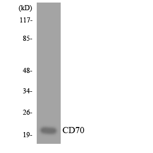 Anti-CD70 Antibody