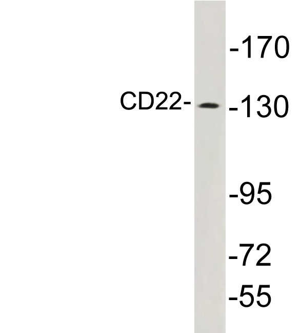 Anti-CD22 Antibody