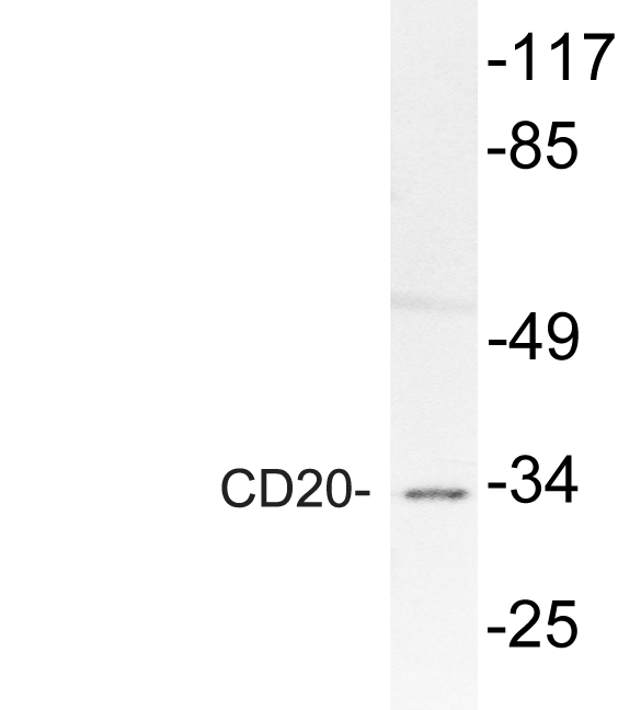 Anti-CD20 Antibody