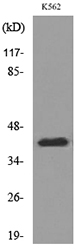 Anti-CD1E Antibody