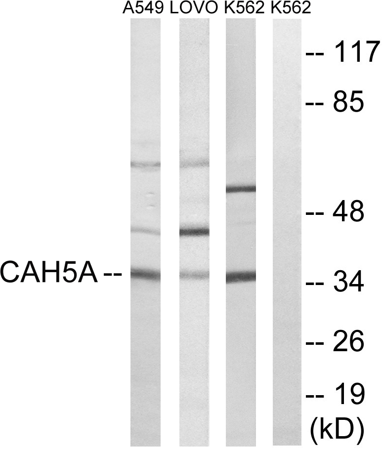 Anti-CA5A Antibody