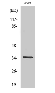 Anti-CA5A Antibody Anti-CA5A Antibody