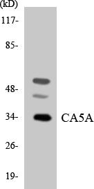 Anti-CA5A Antibody