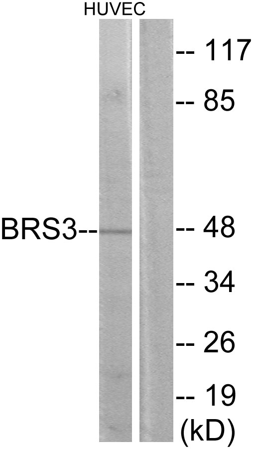 Anti-BRS3 Antibody