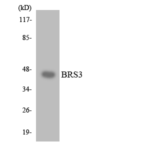 Anti-BRS3 Antibody