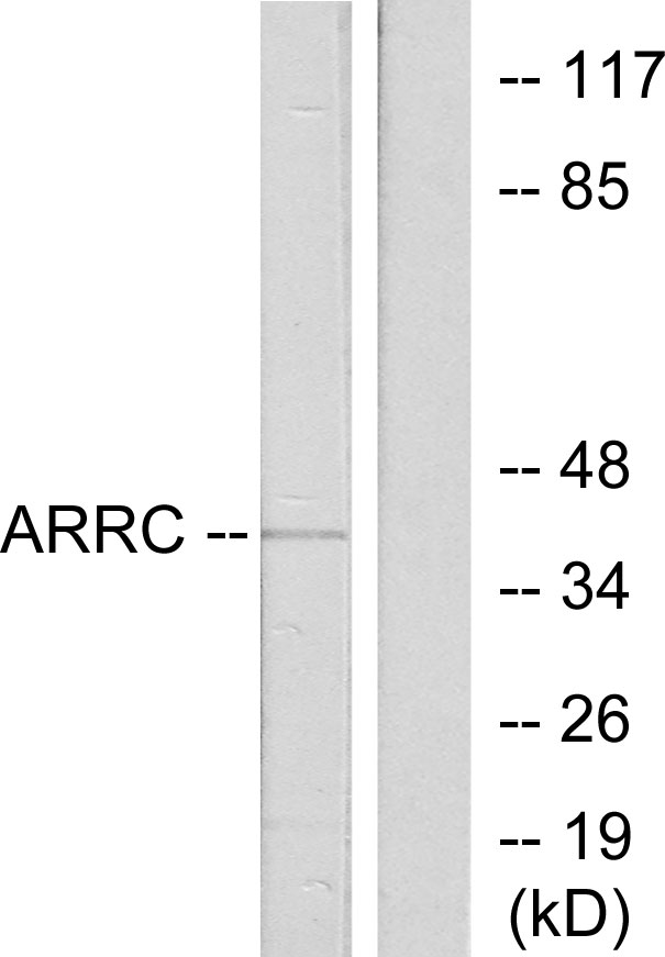 Anti-ARRC Antibody