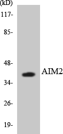 Anti-AIM2 Antibody