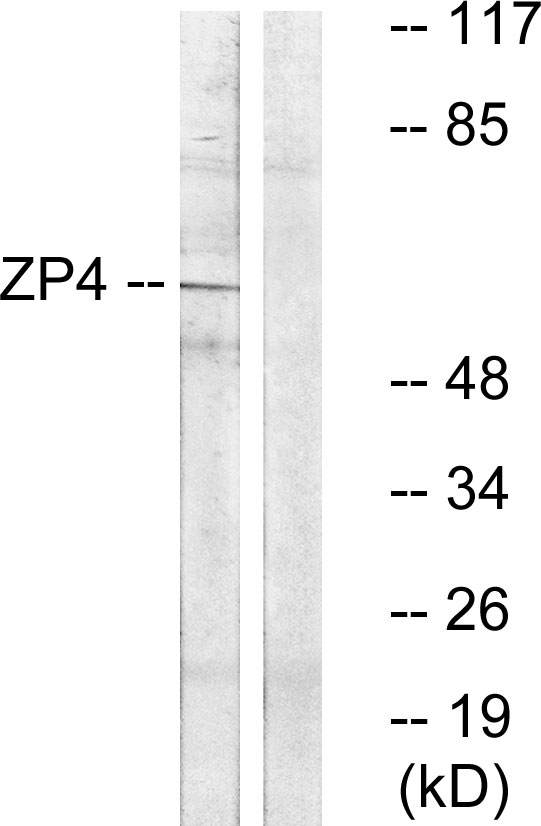 Anti-ZP4 Antibody