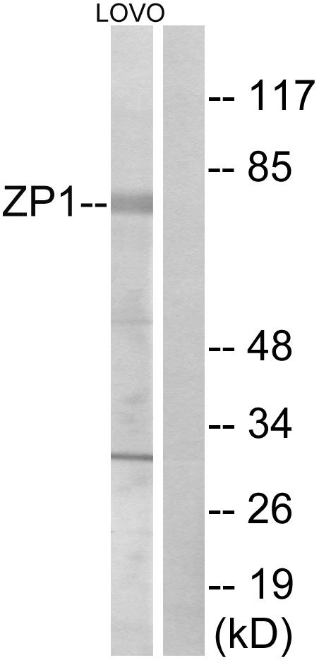 Anti-ZP1 Antibody