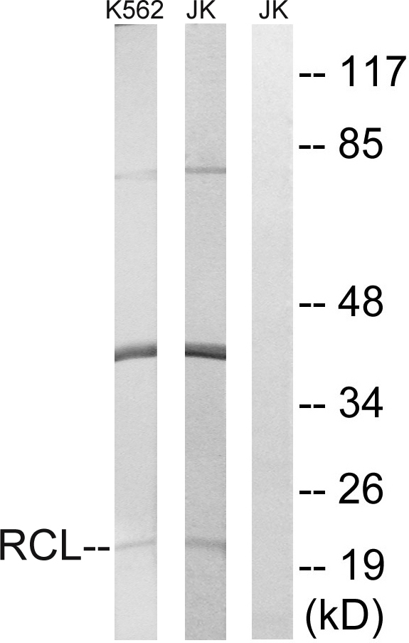 Anti-RCL Antibody