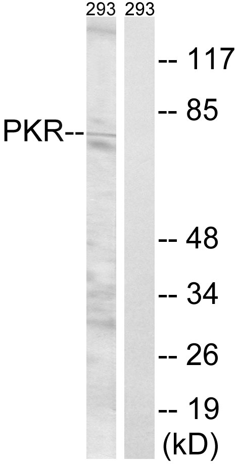 Anti-PKR Antibody
