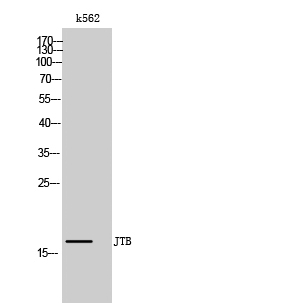 Anti-JTB Antibody