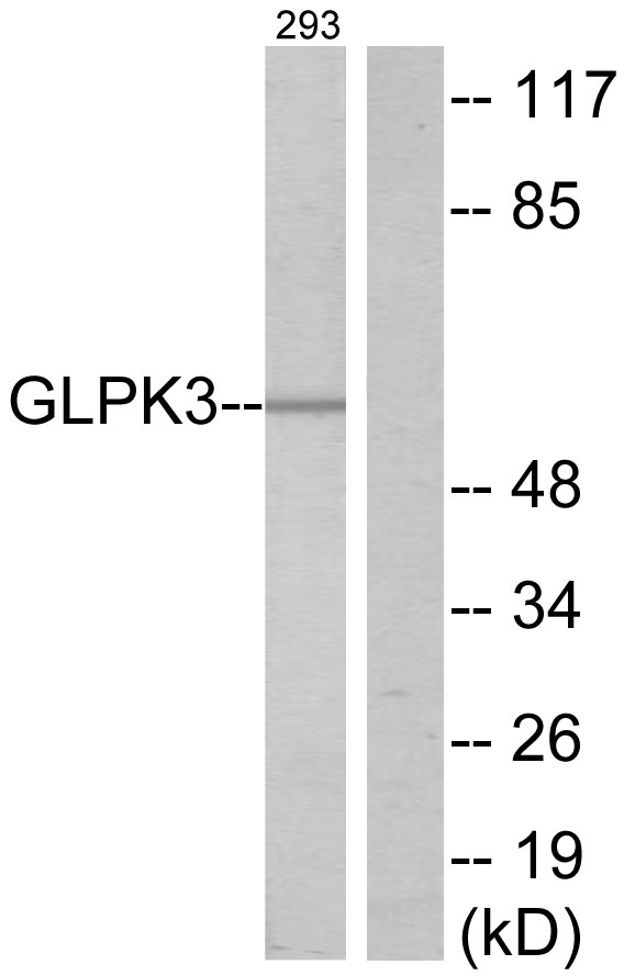 Anti-GK3 Antibody