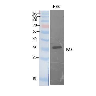 Anti-FAS Antibody