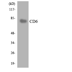 Anti-CD6 Antibody