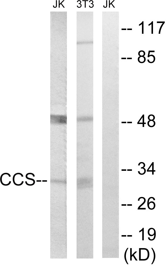 Anti-CCS Antibody