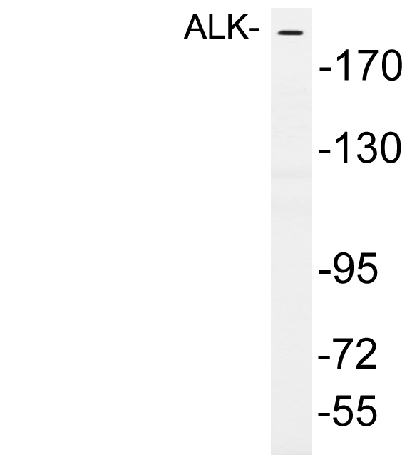 Anti-ALK Antibody
