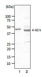 Anti-Campylobacter Porin Antibody [cj-06]