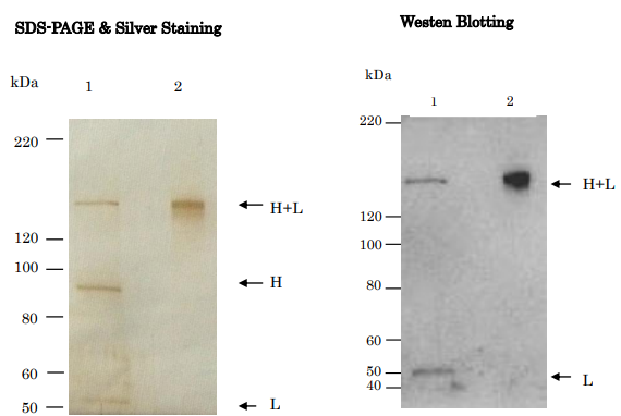 Anti-Tetanus Toxin Antibody [TH-11]