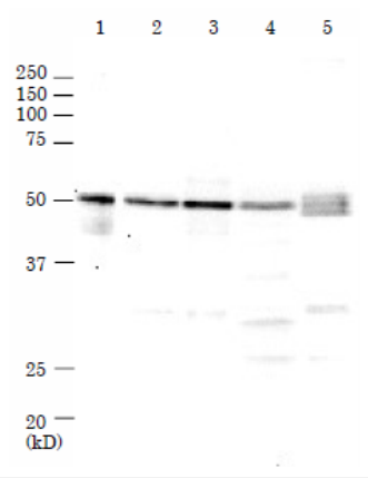 Anti-Rad52 Antibody