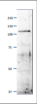 Anti-MCM6 Antibody