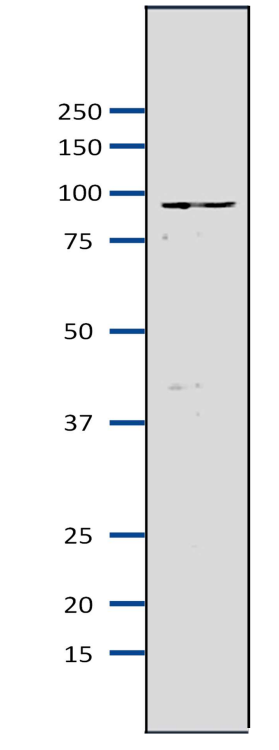 Anti-MCM7 Antibody