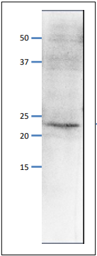 Anti-PSF1 Antibody