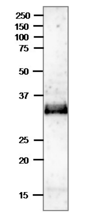 Anti-Ssb2 Antibody