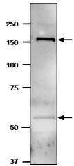Anti-GltBD Antibody