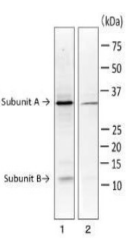 Anti-Heat Labile Enterotoxin Antibody