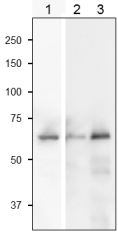 Anti-Sulfite Reductase Antibody