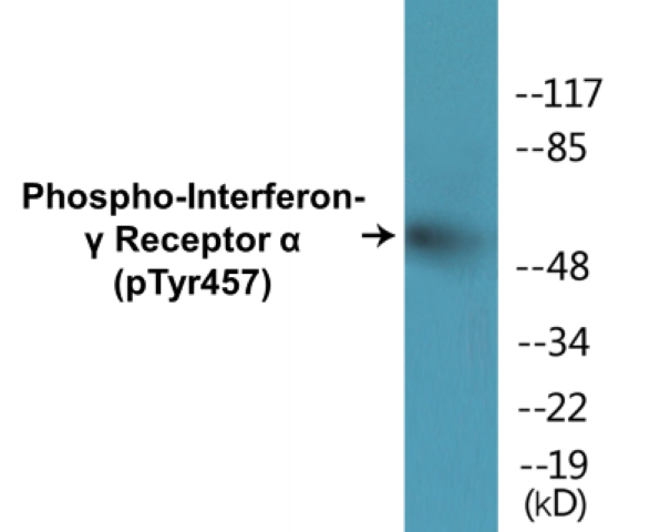 Interferon gamma Receptor alpha (phospho Tyr457) Cell Based ELISA Kit