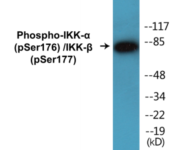 IKK alpha (phospho Ser176) + IKK beta (phospho Ser177) Cell Based ELISA Kit