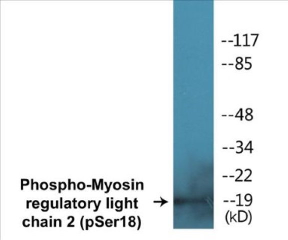 Myosin regulatory light chain 2 (phospho Ser18) Cell Based ELISA Kit