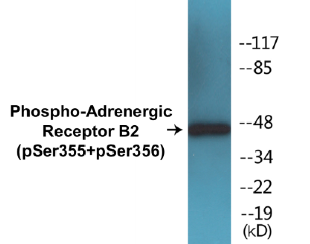 Adrenergic Receptor B2 (phospho Ser355 + Ser356) Cell Based ELISA Kit