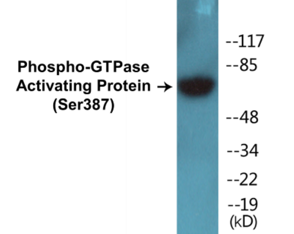 GTPase Activating Protein (phospho Ser387) Cell Based ELISA Kit