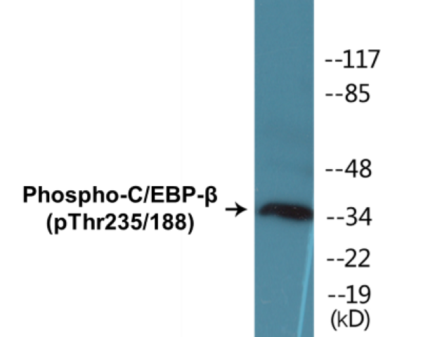 CEBP beta (phospho Thr235 + Thr188) Cell Based ELISA Kit