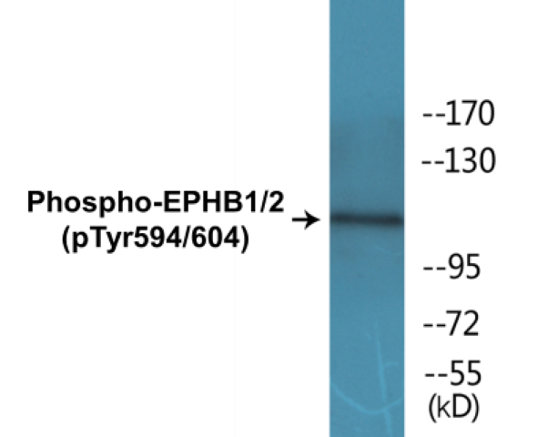 EPHB1 + 2 (phospho Tyr594 + Tyr604) Cell Based ELISA Kit